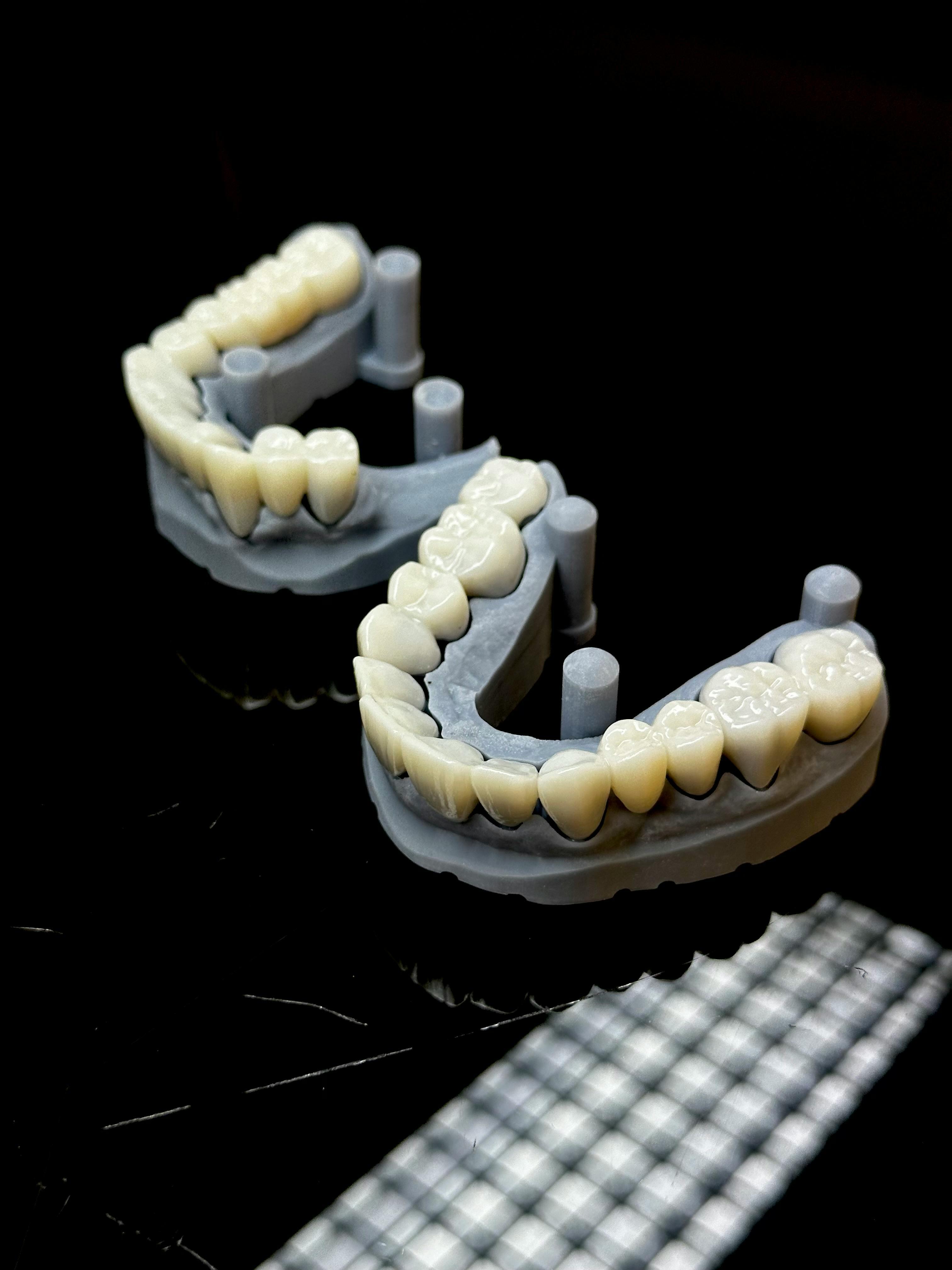 Dental SLA prints